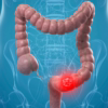 Colorectal Cancer: Get Screened. Get Informed. Get Peace of Mind.